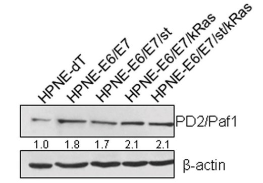 PD2 expression was observed in all the cell lines.jpg